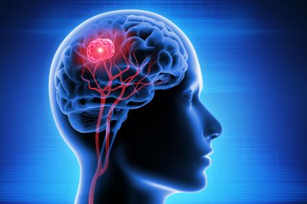 Radar Imaging for Non-Invasive for Brain Imaging and Anamoly Detection