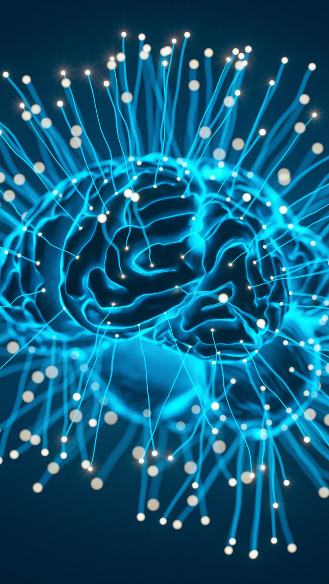Image of brain with connectors